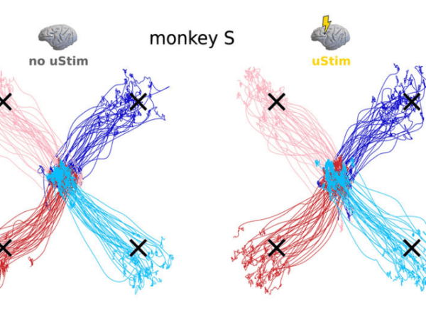 Robustness of Working Memory to Prefrontal Cortex Microstimulation